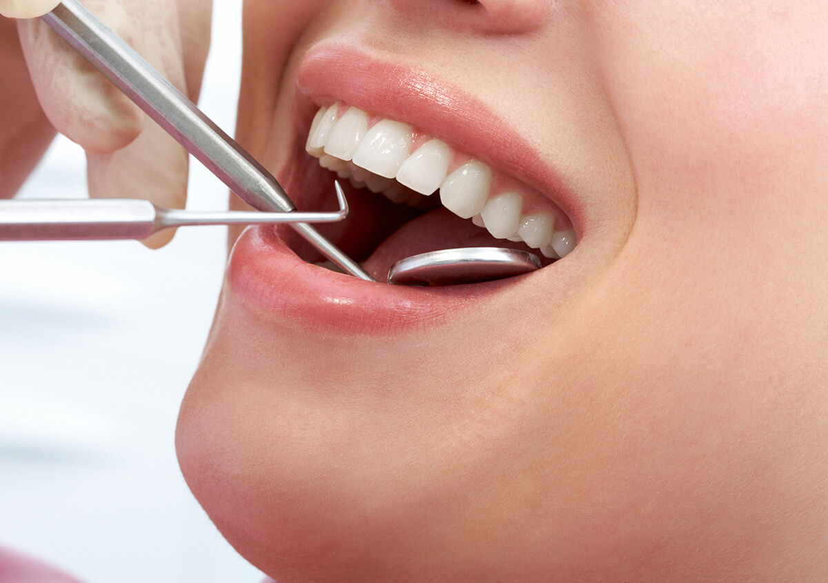 Columbia Dentist Explains Why Professional Teeth Whitening Treatment is the Best Way to Improve Your Smile